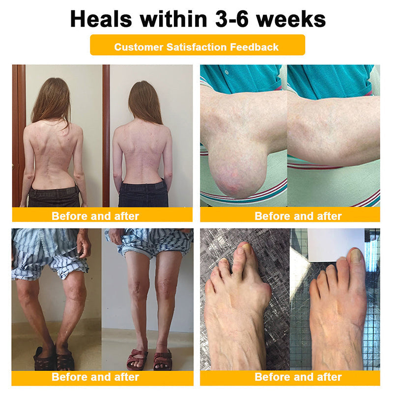 𝒖𝒌 𝑯𝒆𝒂𝒍𝒕𝒉 𝑶𝒏𝒍𝒊𝒏𝒆 | Purelora®🔥 BEE VENOM LITHOSPERMUM Pain-Relief Bone Healing Cream 👑👑(Specially for older adults)