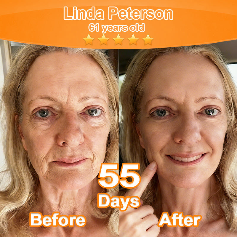 Purelora® Stem Cell Extract EGF and Copper Peptide Revitalizing Essence Cream (deeply activates the internal regeneration of the skin, makes it smoother and softer)