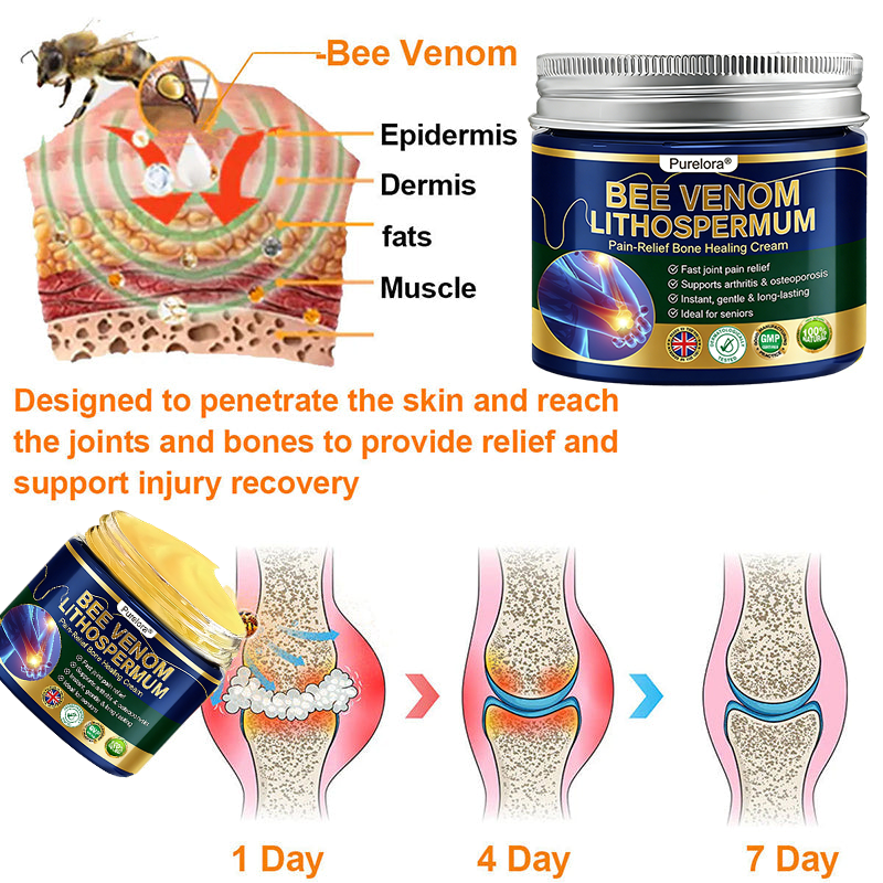 𝒖𝒌 𝑯𝒆𝒂𝒍𝒕𝒉 𝑶𝒏𝒍𝒊𝒏𝒆 | Purelora®🔥 BEE VENOM LITHOSPERMUM Pain-Relief Bone Healing Cream 👑👑(Specially for older adults)