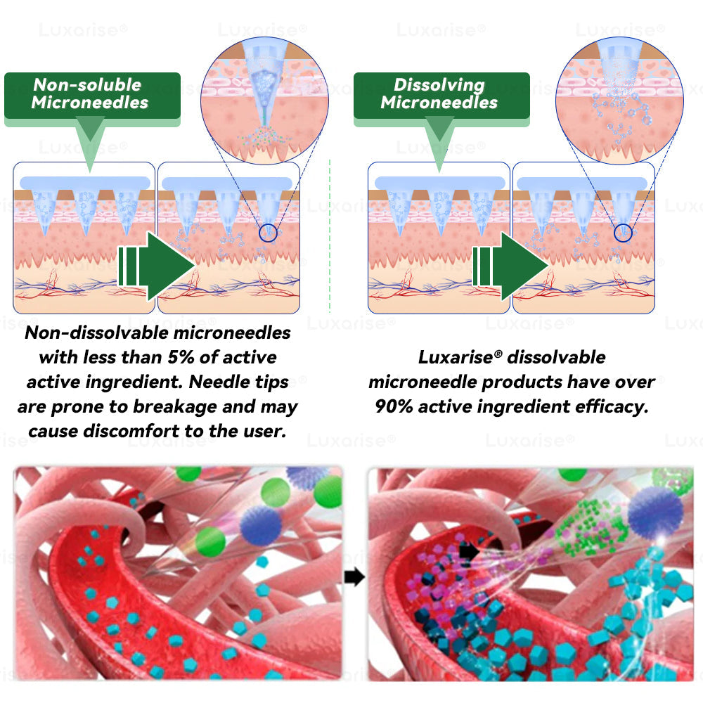 Once Daily, Visible Changes in 7 Days 👨‍🔬 𝑳𝒖𝒙𝒂𝒓𝒊𝒔𝒆® 𝑴𝒐𝒓𝒊𝒏𝒈𝒂 & 𝑩𝒆𝒓𝒃𝒆𝒓𝒊𝒏𝒆 10-𝑰𝑵-1 𝑨𝒅𝒗𝒂𝒏𝒄𝒆𝒅 𝑵𝒂𝒏𝒐 𝑴𝒊𝒄𝒓𝒐𝒏𝒆𝒆𝒅𝒍𝒆 𝑷𝒂𝒕𝒄𝒉 🌿 𝐎𝐛𝐞𝐬𝐢𝐭𝐲, 𝐃𝐢𝐚𝐛𝐞𝐭𝐞𝐬, 𝐒𝐥𝐞𝐞𝐩 𝐀𝐩𝐧𝐞𝐚, 𝐀𝐧𝐝 𝐉𝐨𝐢𝐧𝐭 𝐈𝐬𝐬𝐮𝐞𝐬