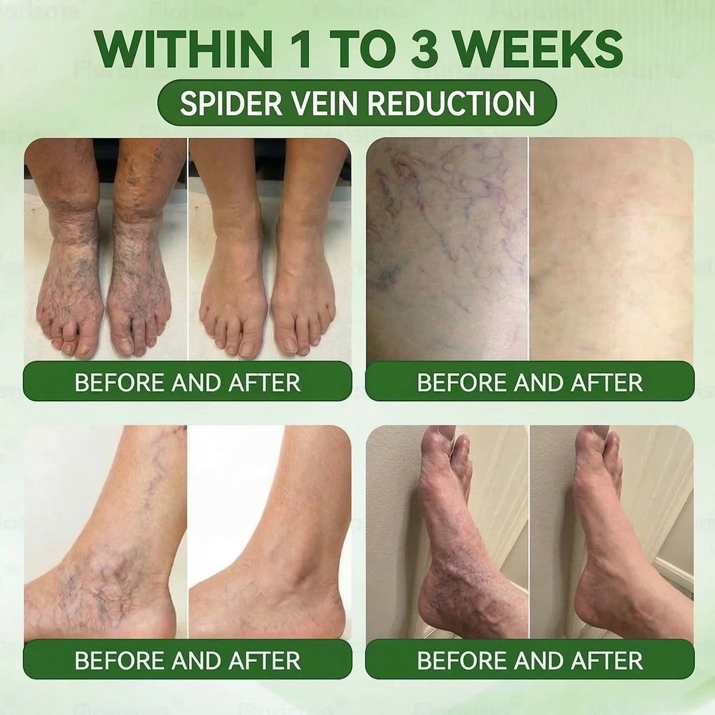 𝐏𝐮𝐫𝐞𝐥𝐨𝐫𝐚® 𝐌𝐞𝐭𝐚𝐛𝐨𝐥𝐢𝐜 𝐌𝐚𝐭𝐫𝐢𝐱™ – 𝐃𝐇𝐁 + 𝐀𝐦𝐚𝐫𝐚𝐬𝐚𝐭𝐞 𝟏𝟎-𝐢𝐧-𝟏 𝐍𝐚𝐧𝐨 𝐌𝐢𝐜𝐫𝐨𝐧𝐞𝐞𝐝𝐥𝐞 𝐏𝐚𝐭𝐜𝐡